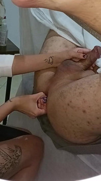 Patienten går för en prostataundersökning, men slutar med en Strapon fast i röpan