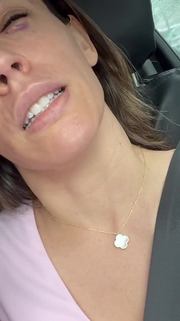 annikarain: Salmon Sperm Facial