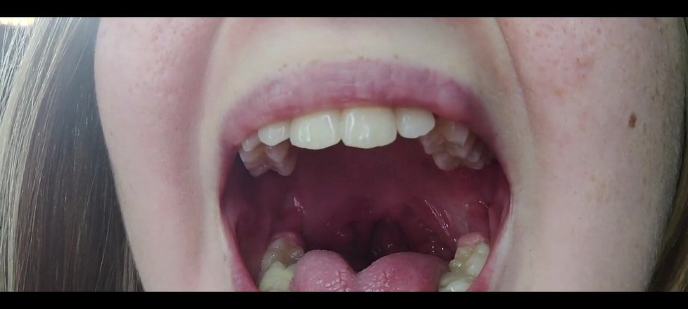 RavenHearth666VIP: 喉咙恋物癖