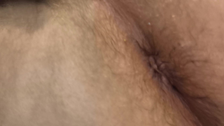 Uglydick: Haarig Ekelig Lecker