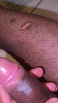 Habesha Dick