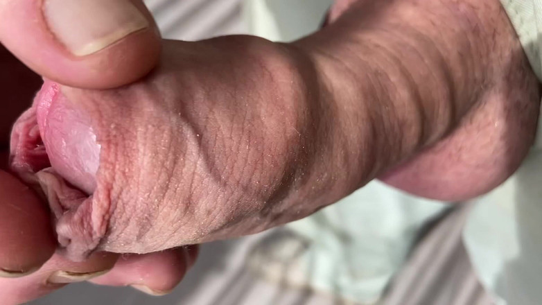 Foreskinguy: 特写撸管撸管巨大的未割包蘑菇鸡巴