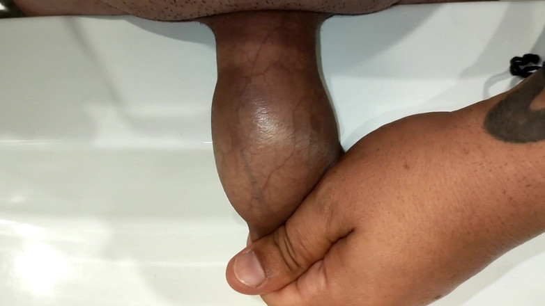 Idmir Sugary: Umflarea preputului cu pișat - Pișare în preput- pișare cu pulă netăiată