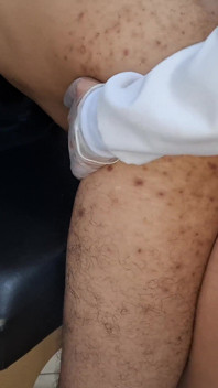 Il est allé chez l’urologue parce qu’il ne sentait plus de plaisir et elle lui a collé son ceinture jusqu’à ce qu’il jouisse.