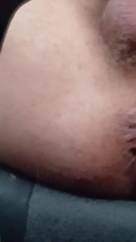 Anus XXX