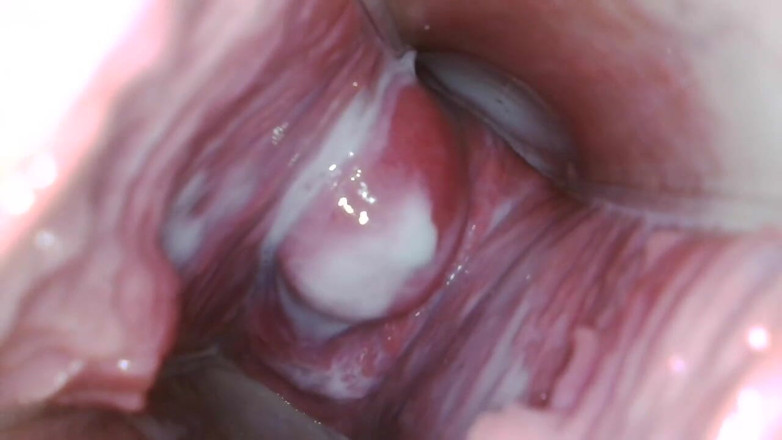JANA studios: Endoscope in my pussy