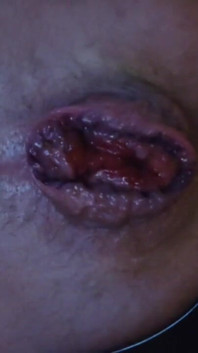 My Hole