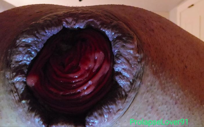 ProlapseLover91: Close-up anale verzakking met opblaasbare kontplug