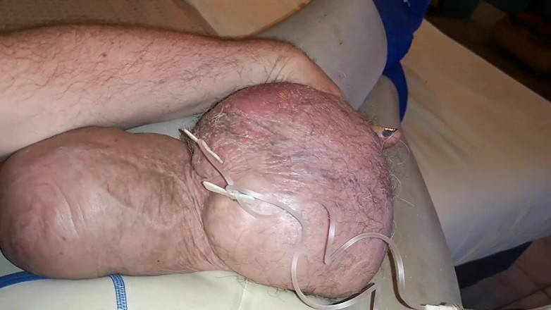 Monster_Meat_: Duplos obturações de glicose de 2liters