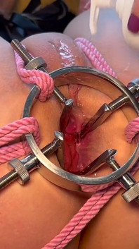 The Bullseye