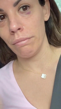 Éjaculation faciale