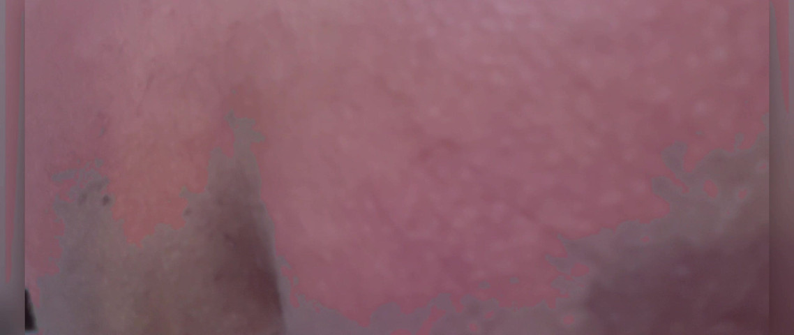 For Today a Simple Video (Rock F hairy)