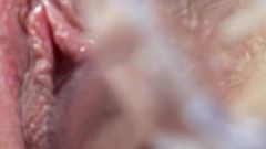 New Gynecological Consultation