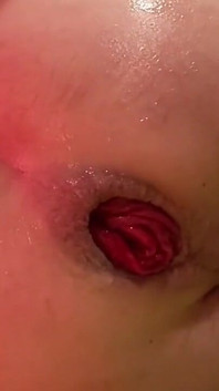 กำปั้นเจาะรูหี prolapse ที่ถูกทำลายจนอ้าปากกว้าง