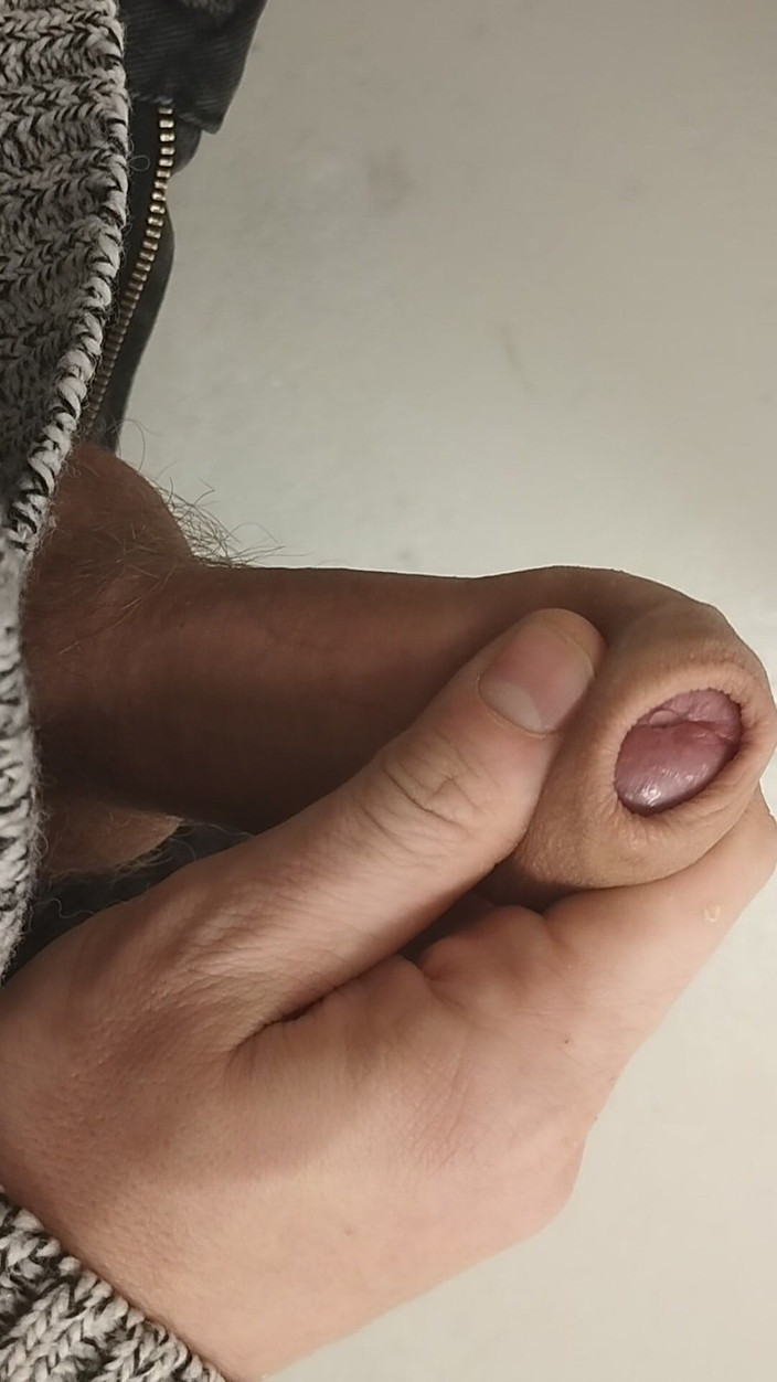 Bayer911: Špinavé tajemství schodiště