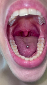 Mouth Tour No Makeup Teeth Tongue Uvula Tonsils Check