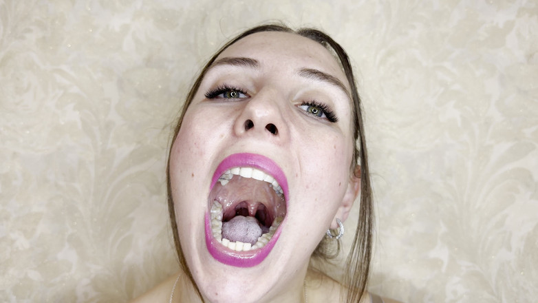 Hottie goddess: Kondisi mulut alami: pemandangan tenggorokan