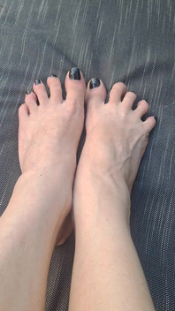 Do We See How Beguiled My Throbbing Foot Veins Are