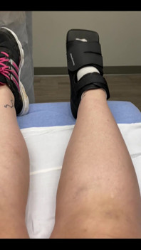 Welp, I messed up my foot