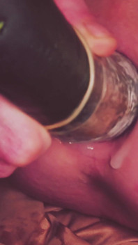Dilatation Anal