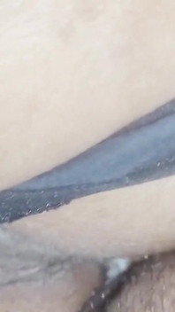 Lateral anal ve çok fazla baskı