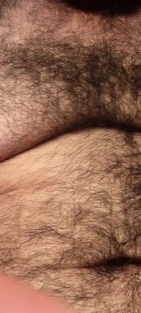 Togliere il mio intestino