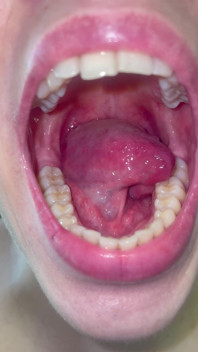 Mondtour geen make-up tanden tong uvula amandelen controleren
