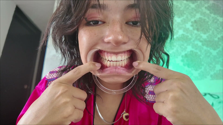 KiyuSweetCrazy: Cheeks Pulled Apart Teeth Exposed