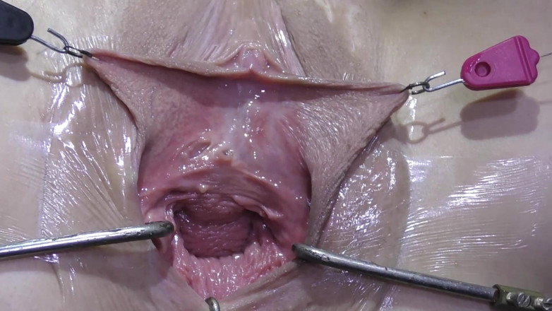 deep keely: Khoảng trống xa