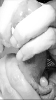 Placer Infinito