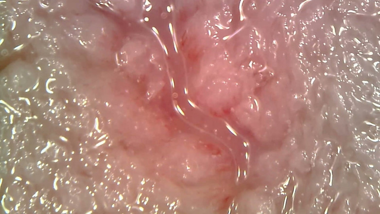 Nicoletta Embassi: Endoscope médical, examen oral : mastication gémissante, dents extrêmes et macro...