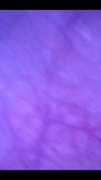 Beautiful Inside POV of My Full Bladder with the Endoscope!