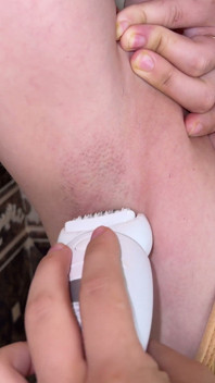 Doğal kıllı genç vücut! Tıraşlı kıllı koltuk altı! Bir epilator ile koltuk altı epilasyonu! Depilasyon!