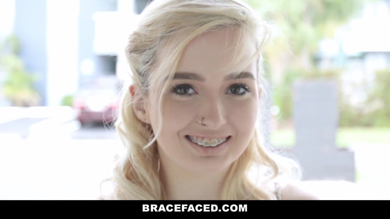 Team Skeet: The bracefaced hook up