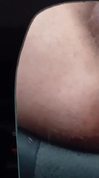 Anus XXX