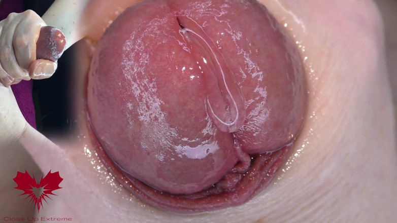 Close Up Extreme: Super close-up van de eikel. Urethrale spelletjes met de dilatator.