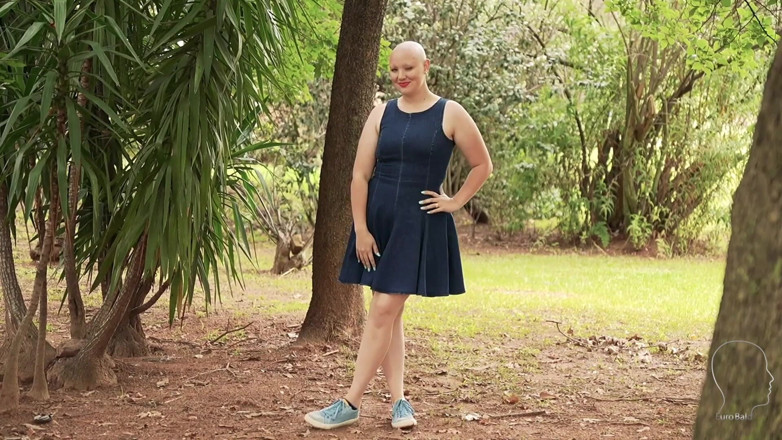 Euro Bald: Beth 1