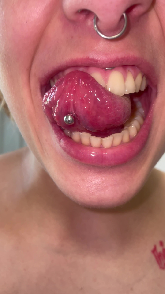 Glitterqueen1999: Wycieczka ustna bez makijażu zębów język Migdałki języczki sprawdź