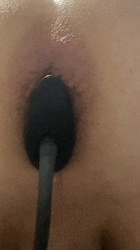 anal stretching