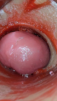Derin Amcık Içindeki Kamera Sperm Asmr'nin aşırı Doz Boşalmasını Yakalıyor