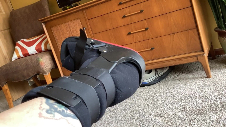 City hog: broken leg fetish