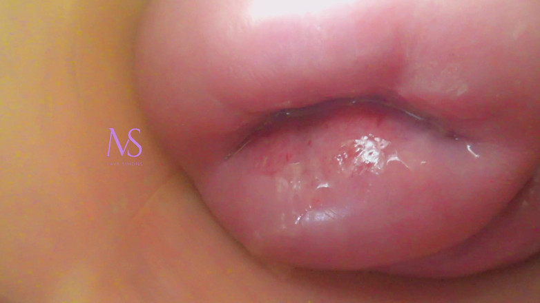 Maya Simons: 子宫颈