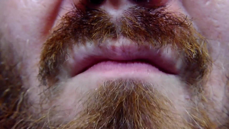 Au79: Tar några hostfall för ont i halsen