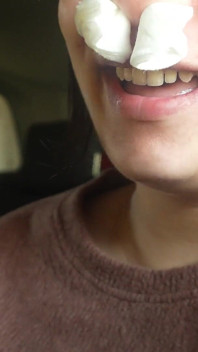 Sneezing Fit in the Car My Plastic Flower Allergy Reaction