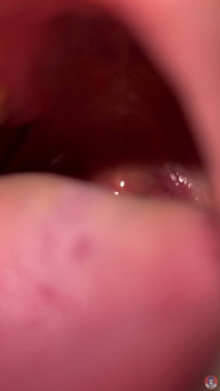 Fetish mulut