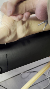 The Lollipop Couldn’t Handle the Pressure