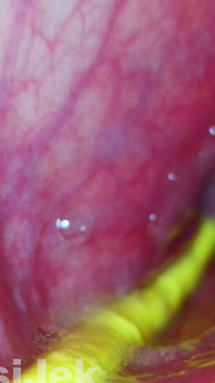 Extreme POV Inside the Action Fuck All Holes My Stepsis with Endoscopy Jessijek