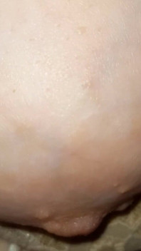 1 Breasts