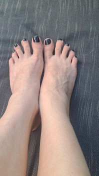 Do We See How Beguiled My Throbbing Foot Veins Are