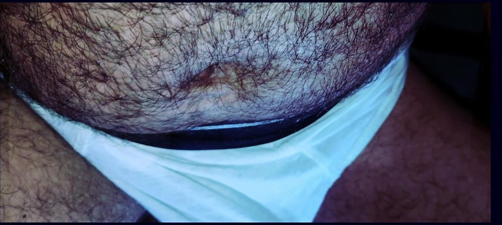 Rock F hairy: My Buttocks